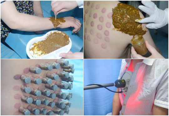 赢博官方网站：向中医药看齐，与世界共享中医药文化(图4)