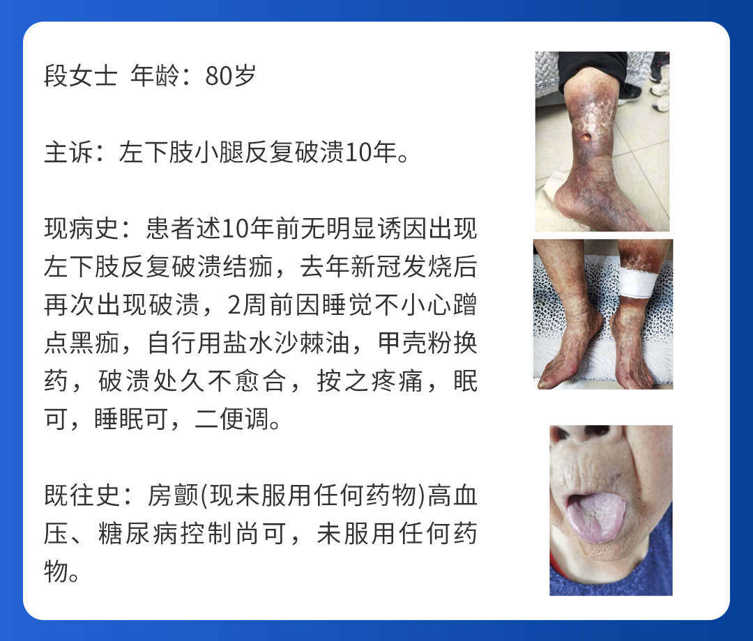 【北京市中西医结合赢博官方网站】第三期会诊(图6)